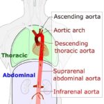 Diferencia entre aorta y arteria pulmonar.