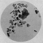 Diferencia entre Azotobacter y Rhizobium