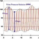 Diferencia entre pulso y presión de pulso