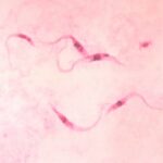 Diferencia entre Trypanosoma cruzi y Trypanosoma rangeli