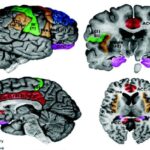 ¿Cuál es la diferencia entre la corteza somatosensorial primaria y secundaria?