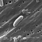 ¿Cuál es la diferencia entre Vibrio Cholerae y Vibrio Parahaemolyticus?