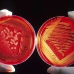 Cómo Rayar un Cultivo Bacteriano