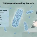 7 Enfermedades Aterradoras Causadas por Bacterias